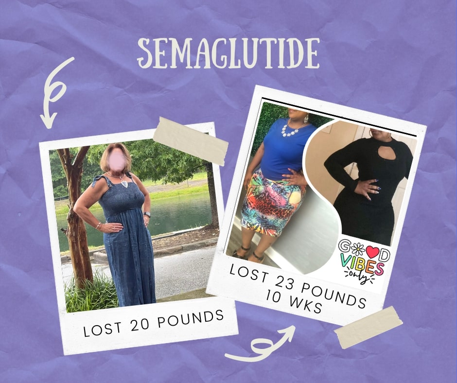 SemagLDeniseDeena Before and After